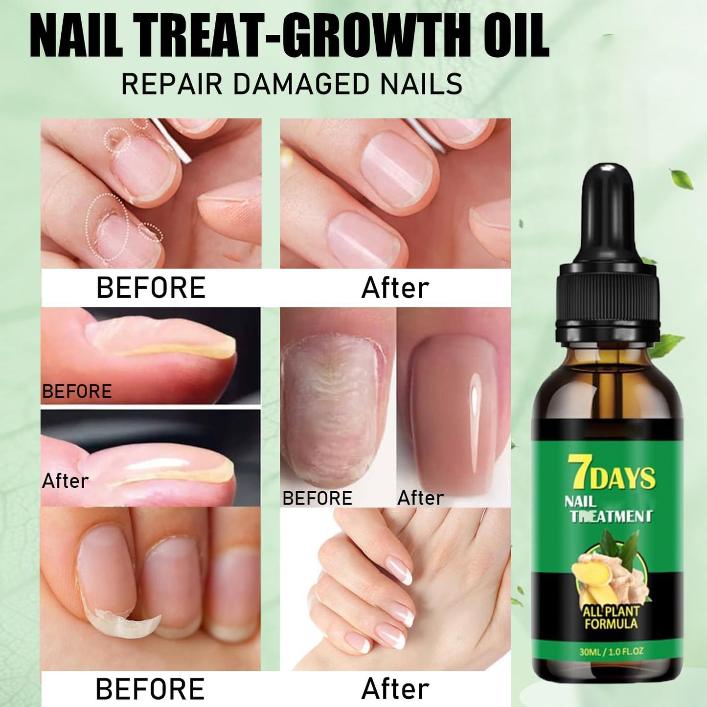 elimina los hongo de 7 años en 7 dias con