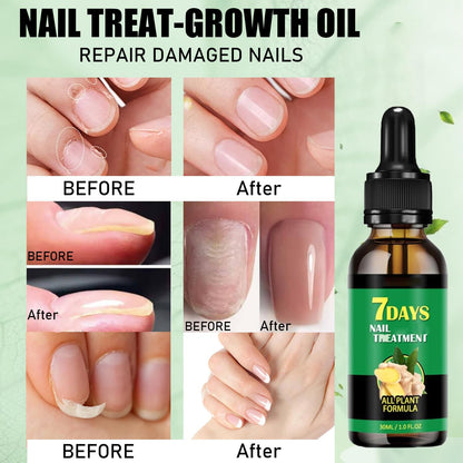 elimina los hongo de 7 años en 7 dias con